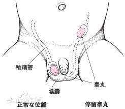 运城治疗睾丸炎哪家医院好自测睾丸炎